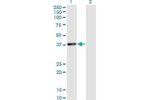Image no. 2 for anti-Hematopoietically Expressed Homeobox (HHEX) (AA 1-270) antibody (ABIN561256)