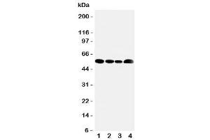 Image no. 4 for anti-Solute Carrier Family 16 (Monocarboxylic Acid Transporters), Member 4 (SLC16A4) (N-Term) antibody (ABIN3032674)