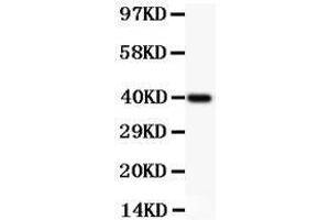 Image no. 5 for anti-Nuclear Factor of kappa Light Polypeptide Gene Enhancer in B-Cells 2 (NFKB2) (AA 1-340) antibody (ABIN3043293)