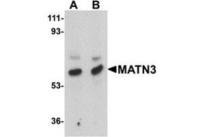 Western Blotting (WB) image for anti-Matrilin 3 (MATN3) (Middle Region) antibody (ABIN1030996)