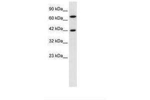 Image no. 2 for anti-TOX High Mobility Group Box Family Member 2 (TOX2) (N-Term) antibody (ABIN6735925)