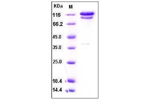 Image no. 1 for Complement C2 (AA 1-752) protein (Fc Tag) (ABIN2002184)