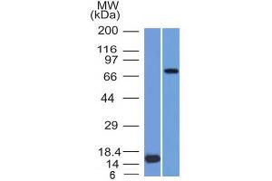 Image no. 1 for anti-Matrix Metalloproteinase 2 (MMP2) (AA 444-575) antibody (ABIN6940067)
