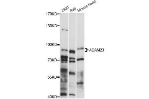 Image no. 1 for anti-ADAM Metallopeptidase Domain 23 (Adam23) antibody (ABIN6292591)