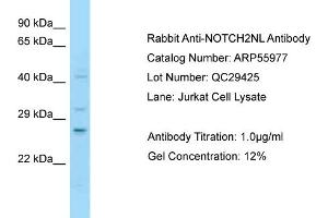 Image no. 1 for anti-Notch 2 N-terminal Like (NOTCH2NL) (C-Term) antibody (ABIN2786463)
