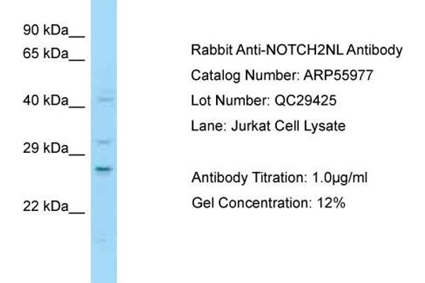 anti-Notch 2 N-terminal Like (NOTCH2NL) (C-Term) antibody