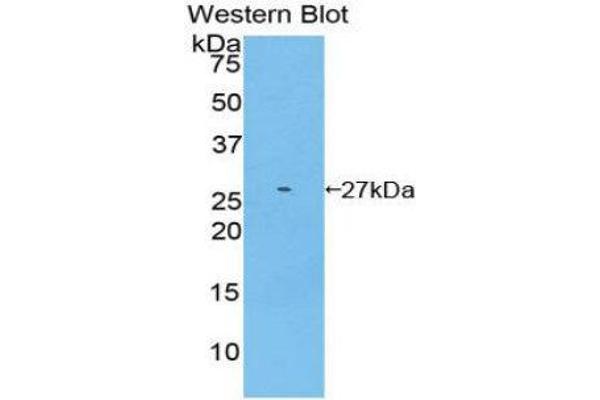 anti-Glutathione S-Transferase mu 2 (Muscle) (GSTM2) (AA 5-202) antibody