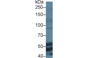 Image no. 2 for anti-Elastin (ELN) (AA 266-443) antibody (ABIN2927510)