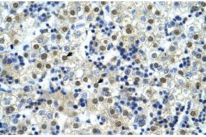 Image no. 3 for anti-Nuclear Transcription Factor Y, gamma (NFYC) (C-Term) antibody (ABIN2780913)