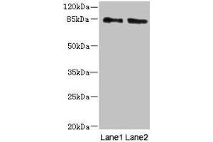 Western blot All lanes: HOOK1 antibody at 4 μg/mL Lane 1: 293T whole cell lysate Lane 2: MCF-7 whole cell lysate Secondary Goat polyclonal to rabbit IgG at 1/10000 dilution Predicted band size: 85, 81 kDa Observed band size: 85 kDa