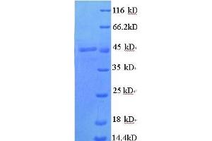 Transcobalamin I (Vitamin B12 Binding Protein, R Binder Family) (TCN1) (AA 25-416), (full length) protein (His tag)