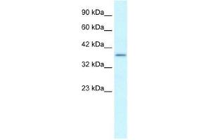 Image no. 3 for anti-SRY (Sex Determining Region Y)-Box 18 (SOX18) (Middle Region) antibody (ABIN1109107)