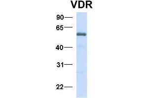 Image no. 5 for anti-Vitamin D Receptor (VDR) (N-Term) antibody (ABIN2776857)