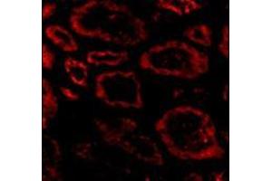 anti-SKI Proto-Oncogene (SKI) (N-Term) antibody