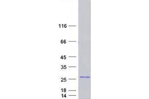 Image no. 1 for Gametocyte Specific Factor 1 (GTSF1) protein (Myc-DYKDDDDK Tag) (ABIN2721670)
