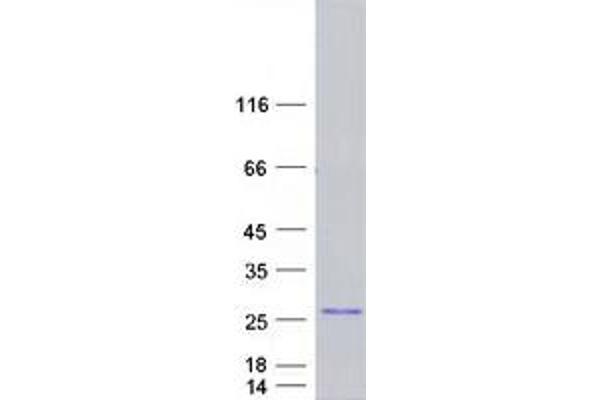 GTSF1 Protein (Gametocyte Specific Factor 1) (Myc-DYKDDDDK Tag)