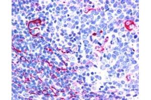 Image no. 2 for anti-Neuroepithelial Cell Transforming 1 (NET1) (C-Term) antibody (ABIN185112)