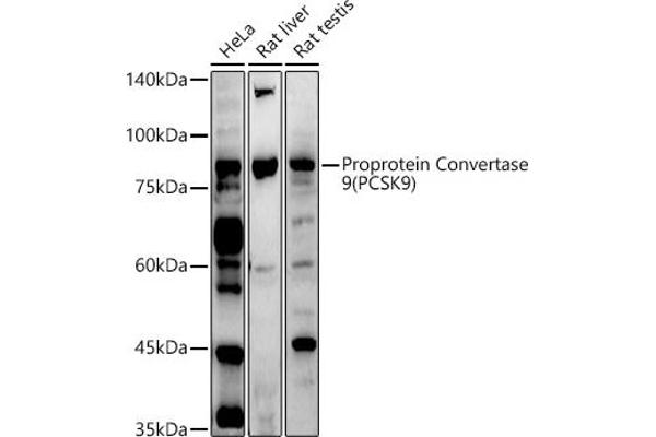 PCSK9 antibody  (C-Term)