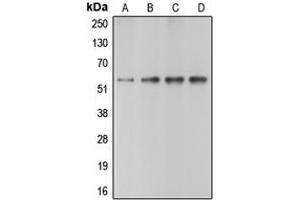 Image no. 3 for anti-Caspase 10, Apoptosis-Related Cysteine Peptidase (CASP10) (C-Term) antibody (ABIN2704575)