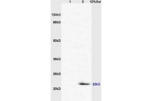 Image no. 3 for anti-CD69 (CD69) (AA 101-199) antibody (ABIN741150)
