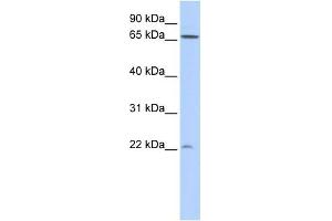 Image no. 1 for anti-DIRAS Family, GTP-Binding RAS-Like 1 (DIRAS1) (N-Term) antibody (ABIN2785102)