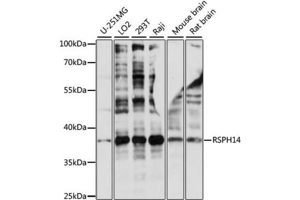 anti-Rhabdoid Tumor Deletion Region Gene 1 (RTDR1) antibody