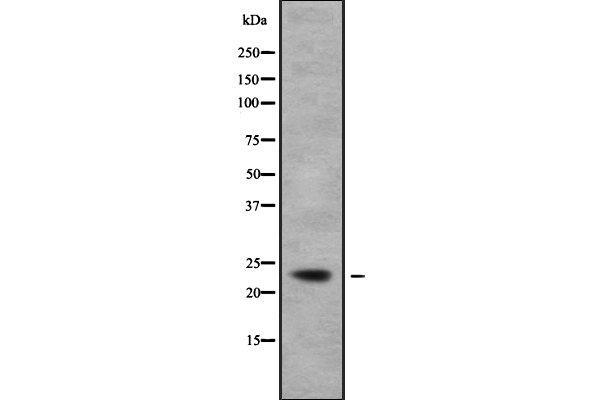 TCEAL5 antibody  (Internal Region)