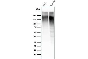 Image no. 1 for anti-Antigen Identified By Monoclonal Antibody Ki-67 (MKI67) (AA 2293-2478) antibody (ABIN6940053)