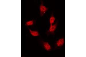 Image no. 9 for anti-GATA Binding Protein 4 (GATA4) (pSer105) antibody (ABIN6256094)
