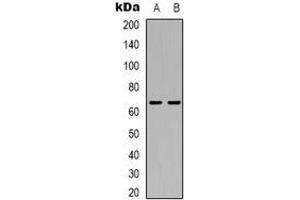 Image no. 3 for anti-Thyroid Hormone Receptor Interactor 4 (TRIP4) antibody (ABIN2801392)