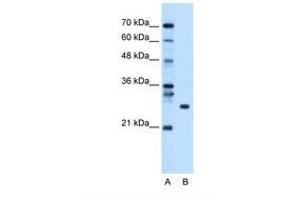 Image no. 1 for anti-RNA Binding Protein with Multiple Splicing (RBPMS) (AA 43-92) antibody (ABIN320529)