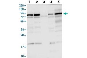 Image no. 3 for anti-DENN/MADD Domain Containing 1C (DENND1C) antibody (ABIN5576547)
