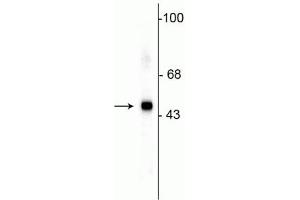 Image no. 1 for anti-Splicing Factor 3b, Subunit 4, 49kDa (SF3B4) antibody (ABIN6254113)