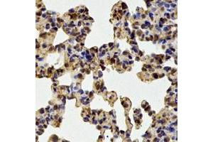 Image no. 1 for anti-Proteasome Subunit alpha Type 1 (PSMA1) (full length) antibody (ABIN6005028)