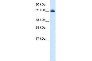 Image no. 1 for anti-Zinc Finger and BTB Domain Containing 45 (ZBTB45) (Middle Region) antibody (ABIN2779240)