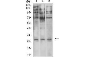 Image no. 6 for anti-Elastase, Neutrophil Expressed (ELANE) (AA 140-267) antibody (ABIN5611333)
