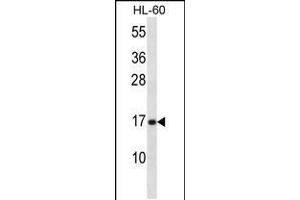 anti-phospholipase A2, Group V (PLA2G5) (AA 103-132), (C-Term) antibody