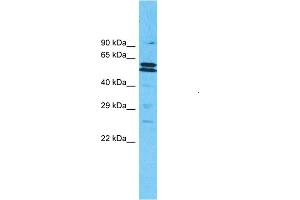 Image no. 3 for anti-Protein AF-9 (MLLT3) (N-Term) antibody (ABIN2780604)