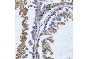 Image no. 7 for anti-Inositol(myo)-1(or 4)-Monophosphatase 1 (IMPA1) antibody (ABIN6142429)