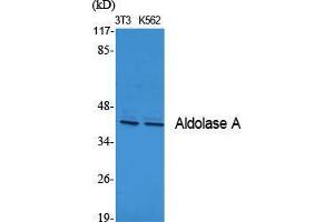 Image no. 2 for anti-Aldolase A, Fructose-Bisphosphate (ALDOA) (N-Term) antibody (ABIN3180480)