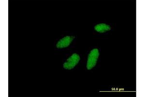 Image no. 2 for anti-Cell Cycle Checkpoint Protein RAD1 (RAD1) (AA 1-282) antibody (ABIN519540)