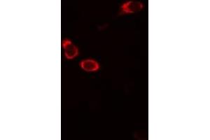 Image no. 1 for anti-Thioredoxin Reductase 2 (TXNRD2) antibody (ABIN6265819)