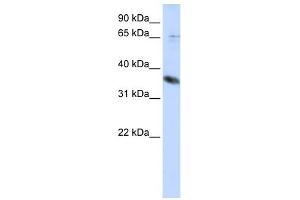 Image no. 1 for anti-ST6 (Alpha-N-Acetyl-Neuraminyl-2,3-beta-Galactosyl-1,3)-N-Acetylgalactosaminide alpha-2,6-Sialyltransferase 1 (ST6GALNAC1) antibody (ABIN636045)