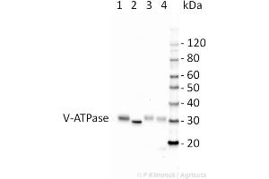 Image no. 2 for anti-ATPase, H+ Transporting, Lysosomal 38kDa, V0 Subunit D2 (ATP6V0D2) (Isoform 1) antibody (ABIN3197488)