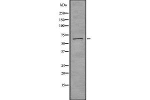 Image no. 2 for anti-CTP Synthase (CTPS) (C-Term) antibody (ABIN6261098)