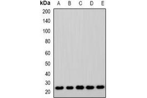 Image no. 2 for anti-ASF1 Anti-Silencing Function 1 Homolog A (S. Cerevisiae) (ASF1A) antibody (ABIN3222820)