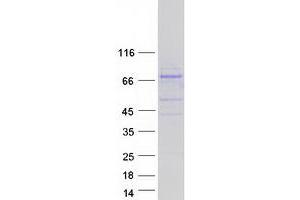 Image no. 1 for phosphoinositide Kinase, FYVE Finger Containing (PIKFYVE) (Transcript Variant 4) protein (Myc-DYKDDDDK Tag) (ABIN2729012)