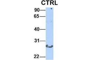 Image no. 3 for anti-Chymotrypsin (CTRL) (N-Term) antibody (ABIN2778163)