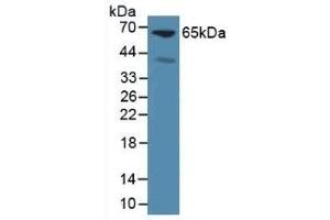 Glypican 3 抗体  (AA 344-559)