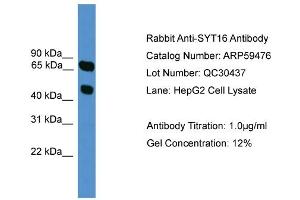 Image no. 2 for anti-Synaptotagmin XVI (SYT16) (N-Term) antibody (ABIN2788084)